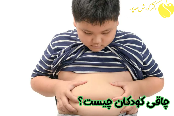چاقی کودکان چیست